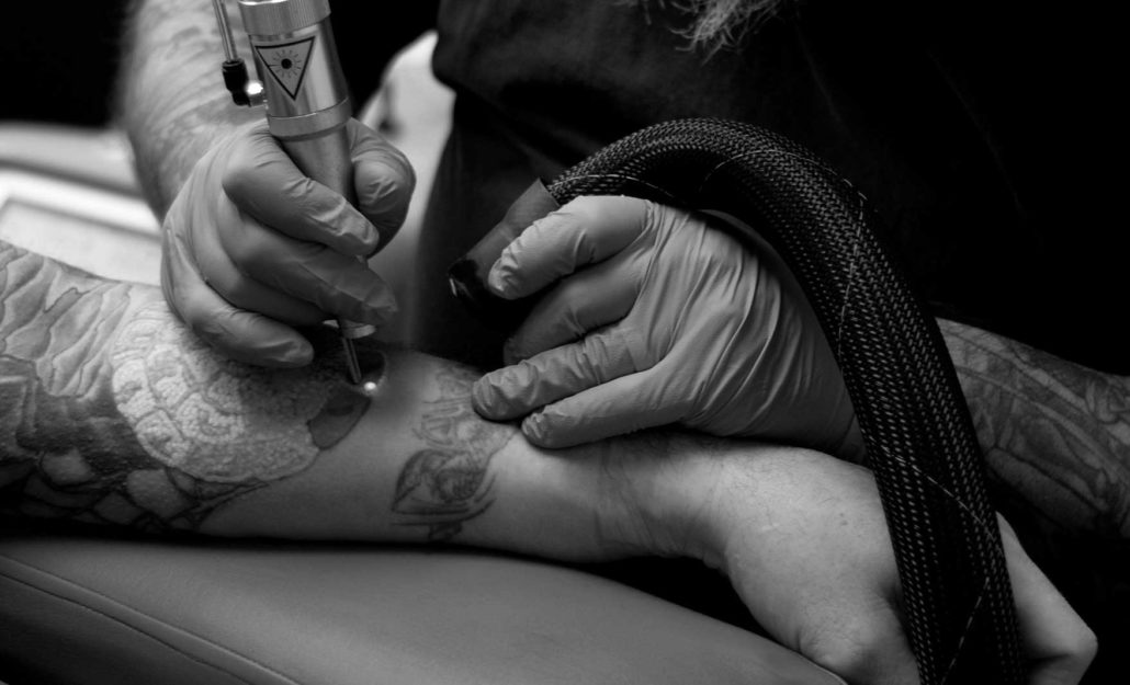 Monday Magazine Feature's Pete, Laser Tattoo Removal in Victoria – Urge  Tattoos – Voted Victoria's Best Tattoo Shop